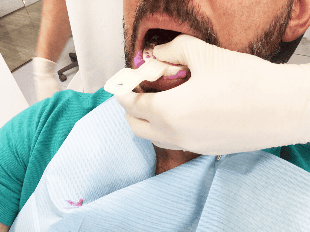 se puede quitar el bruxismo dentista en valencia