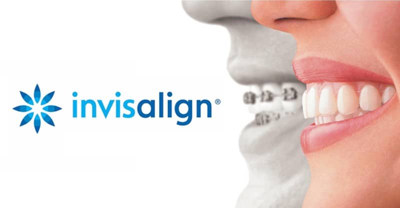 Invisalign - Clinica Dental C.O.V.