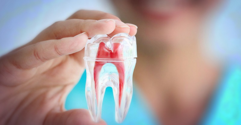Endodoncia - Clinica Cov