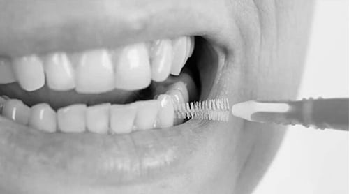 Cepillado Implantes Dentales