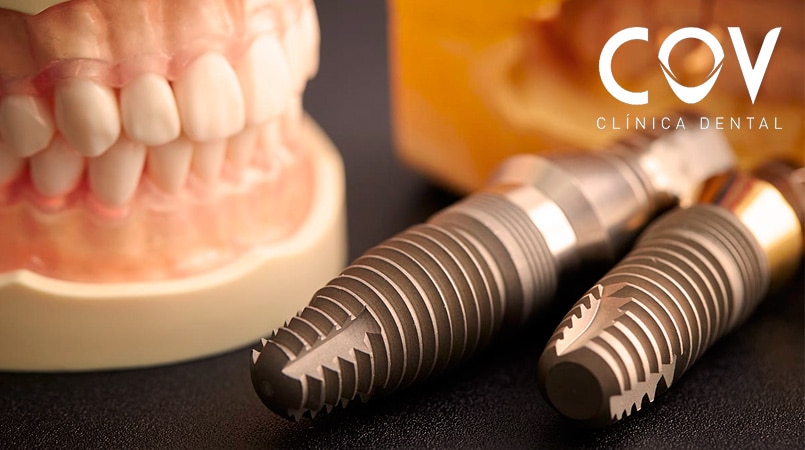 Cuidado Implantes Dentales