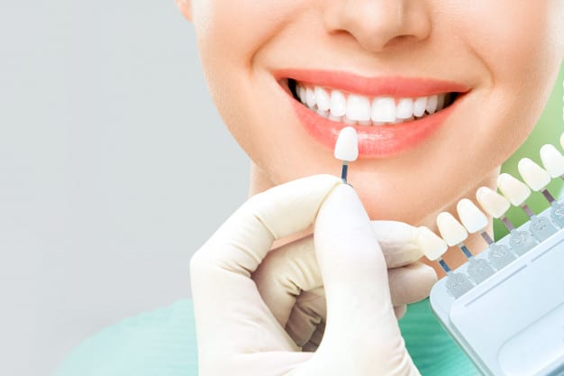 Blanqueamiento Dental